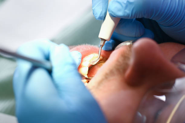 Best Emergency Root Canal Therapy in Brodhead, KY
