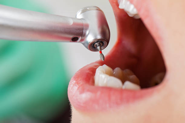 Trusted KY Emergency Dental Service Experts